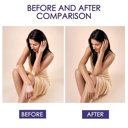 EverGlow™ Skin Concealer Cream | Last Day Of Sale!