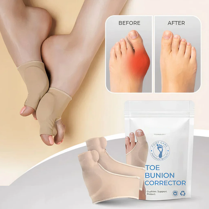 Orthopedic Bunion Corrector - Clickermans